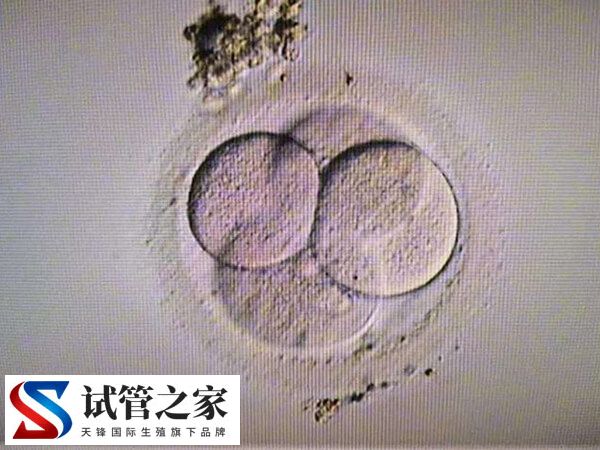 更年期做试管婴儿要怎么调理(图1)