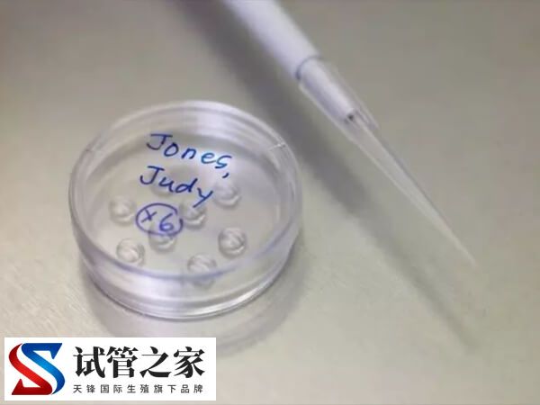 6cc囊胚还有没有必要移植(图1) 6cc囊胚还有没有必要移植(图1)