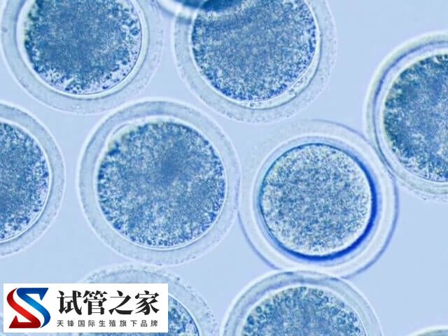 什么原因造成一卵多精(图2) 什么原因造成一卵多精(图2)