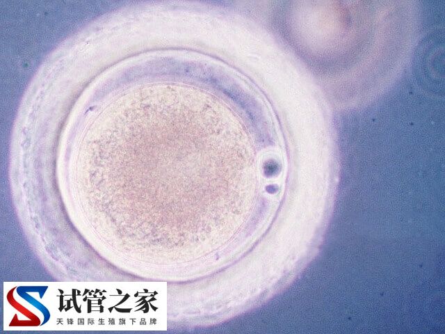什么原因造成胚胎三倍体(图1) 什么原因造成胚胎三倍体(图1)