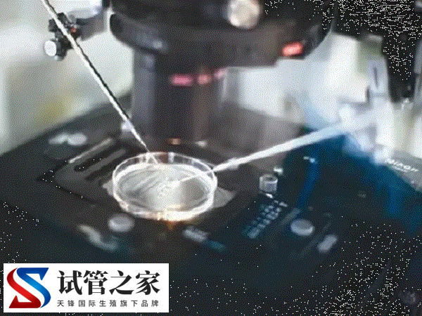 什么情况下囊胚需要辅助孵化(图2) 什么情况下囊胚需要辅助孵化(图2)