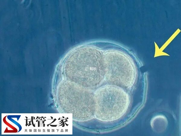 什么叫人体胚胎孵化项目(图1) 什么叫人体胚胎孵化项目(图1)