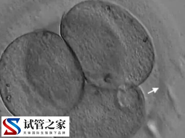 什么叫人体胚胎孵化项目(图2) 什么叫人体胚胎孵化项目(图2)