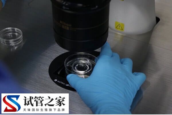 试管移植第17天出血的原因有几种(图3) 试管移植第17天出血的原因有几种(图3)