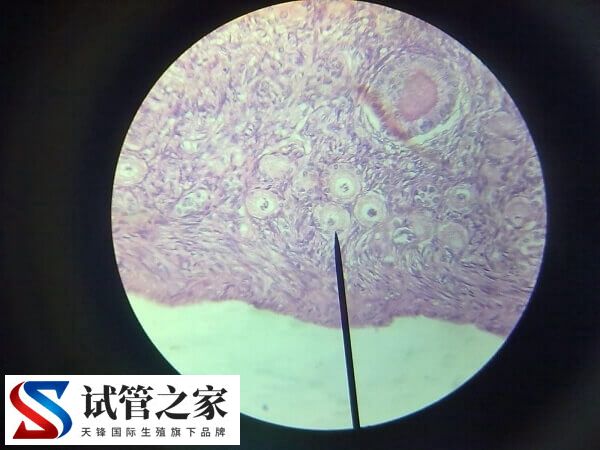 绒促性素是什么药(图3) 绒促性素是什么药(图3)