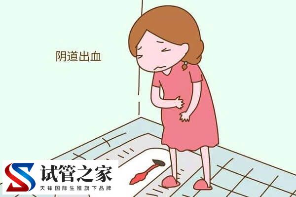 促排用普丽康和果纳芬哪个效果好(图3) 促排用普丽康和果纳芬哪个效果好(图3)