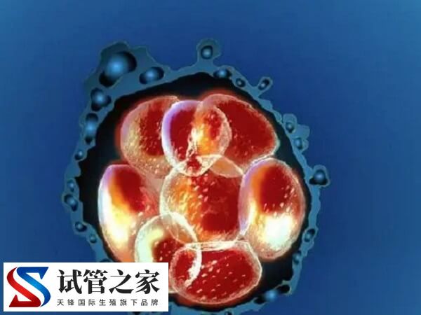试管婴儿产生心脏畸形是怎么回事(图2) 试管婴儿产生心脏畸形是怎么回事(图2)
