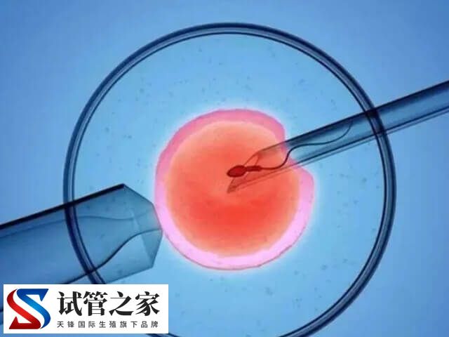 精子库的精子质量分哪些档次(图2) 精子库的精子质量分哪些档次(图2)