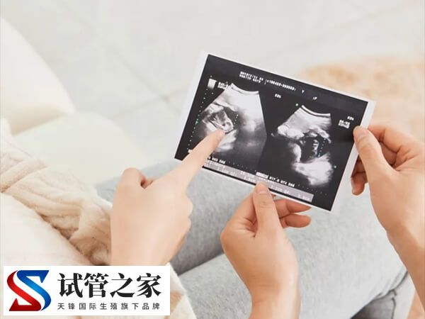 三代试管婴儿囊胚移植宫外孕多久能确诊查出来?(图1) 三代试管婴儿囊胚移植宫外孕多久能确诊查出来?(图1)