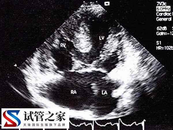 监测卵泡子宫内膜en分型是a好还是b好？