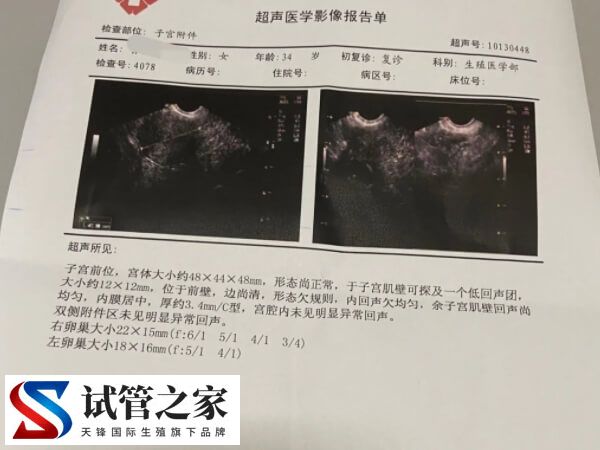 amh检查正常但是窦卵泡数量少是怎么回事?(图1) amh检查正常但是窦卵泡数量少是怎么回事?(图1)