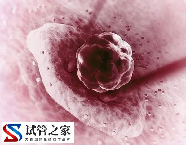 试管移植后受到惊吓影不影响着床(图2) 试管移植后受到惊吓影不影响着床(图2)