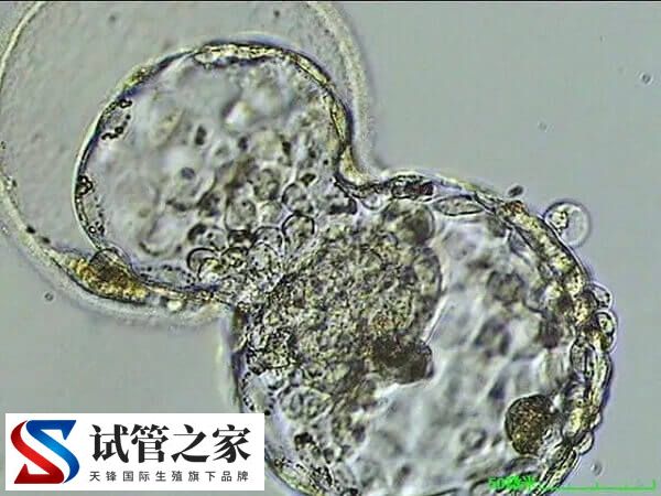 6bb囊胚容不容易生男孩(图1) 6bb囊胚容不容易生男孩(图1)