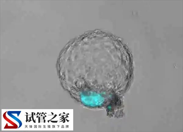 6bb囊胚容不容易生男孩(图3) 6bb囊胚容不容易生男孩(图3)