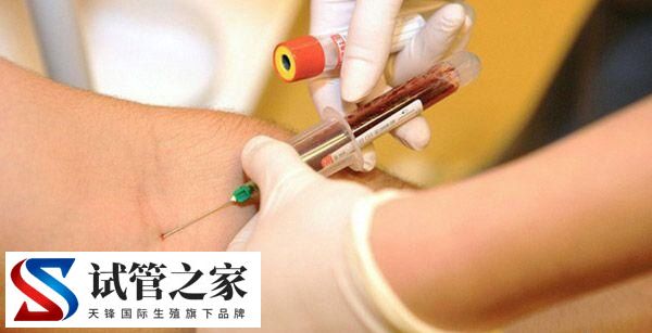 性激素六项检查报告单怎么看(图1) 性激素六项检查报告单怎么看(图1)