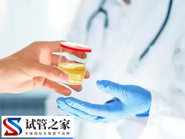 试管婴儿前为什么要检查肾功能