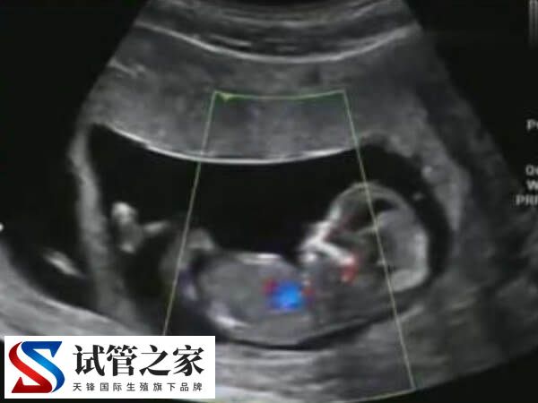 胚胎移植过后需要注意什么(图2) 胚胎移植过后需要注意什么(图2)