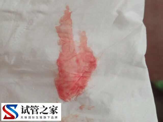 鲜胚移植13天成功有什么症状(图1) 鲜胚移植13天成功有什么症状(图1)