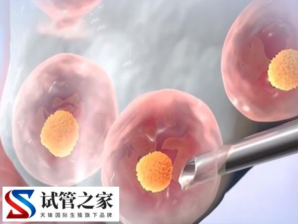 地中海贫血试管婴儿如何做(图1) 地中海贫血试管婴儿如何做(图1)