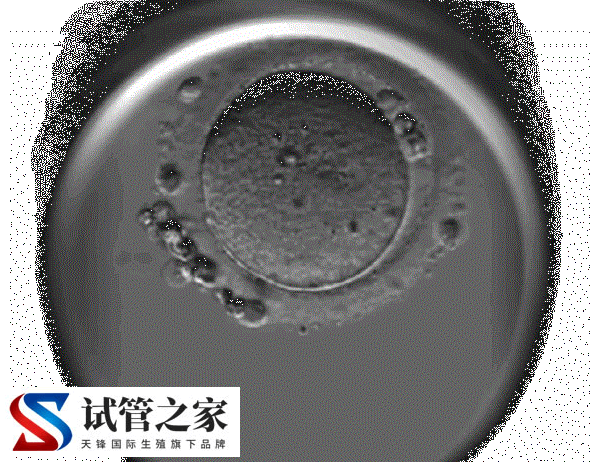 试管婴儿移植三级胚胎的成功率有40%吗?(图1) 试管婴儿移植三级胚胎的成功率有40%吗?(图1)