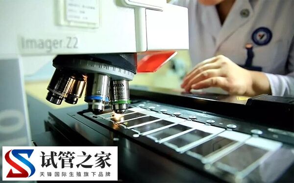 高龄做试管婴儿前要注意什么