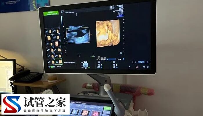 孕早期阴道B超有没有必要做