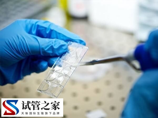 取卵时能不能看出卵子质量