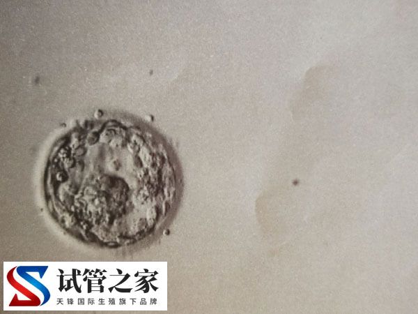 5天的囊胚5bb质量成功率有多高