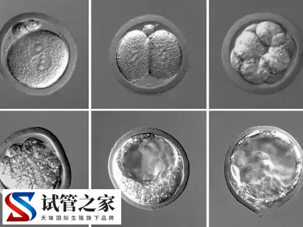 受精卵解冻失败的概率多高