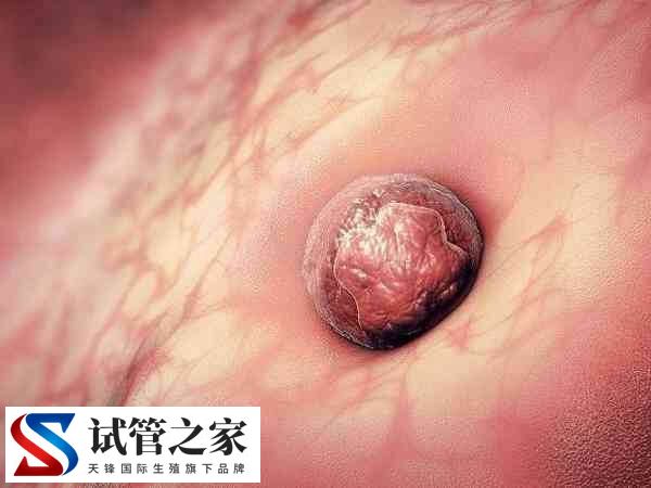 子宫内膜活跃对胚胎着床好不好