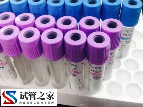 试管哪些检查一年后要重新查